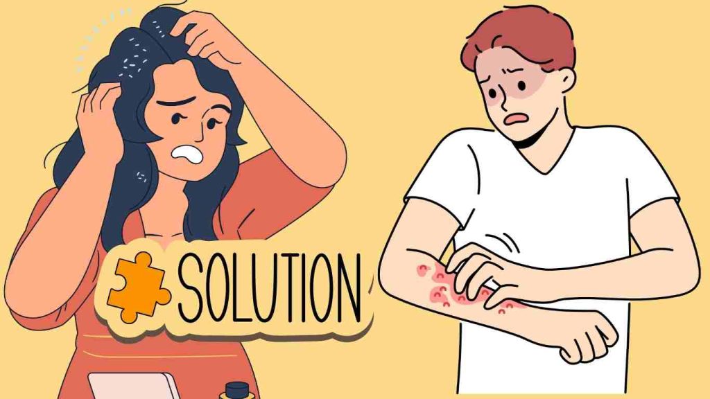 Home Remedies for Dandruff and Itchy Scalp: 10 Proven Solutions
