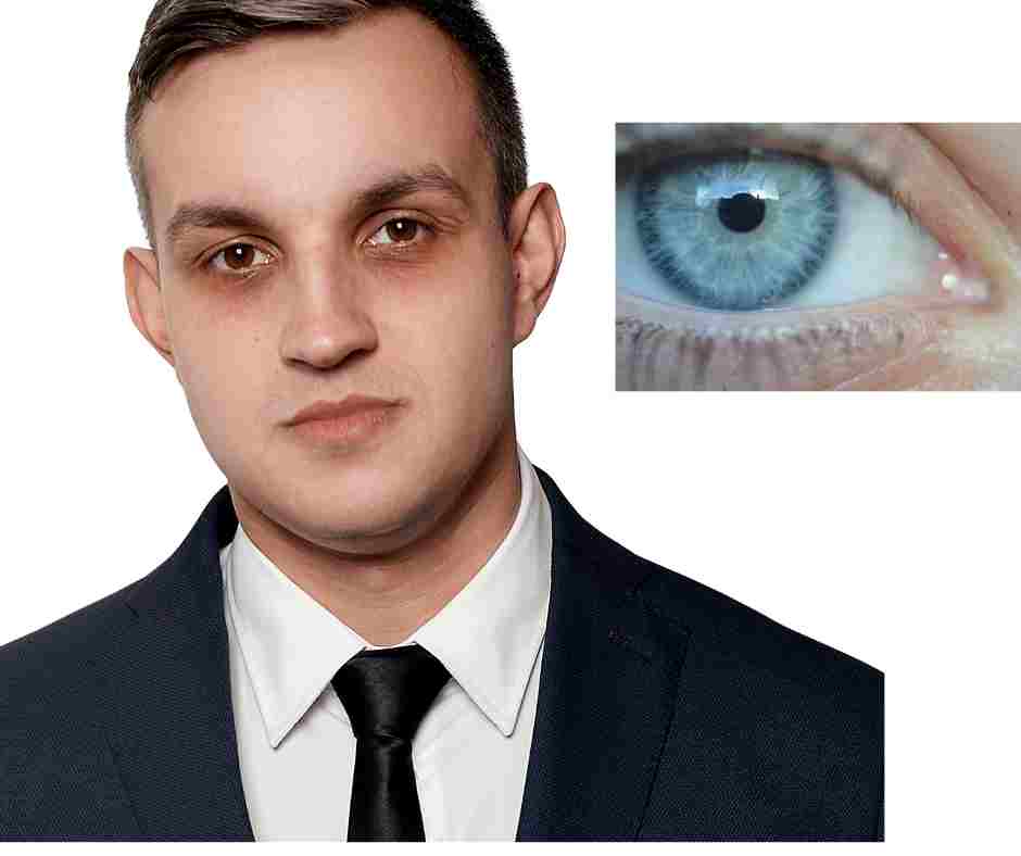 Natural Remedies for Dark Circles Under Eyes