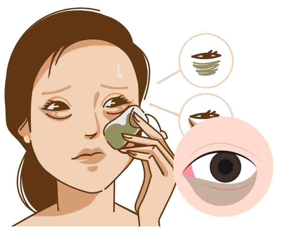 Natural Remedies for Dark Circles Under Eyes: 7 That Work